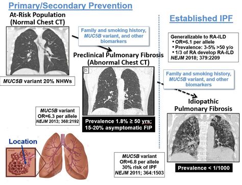 obev|Ofev® Indicated for Idiopathic Pulmonary Fibrosis (IPF)